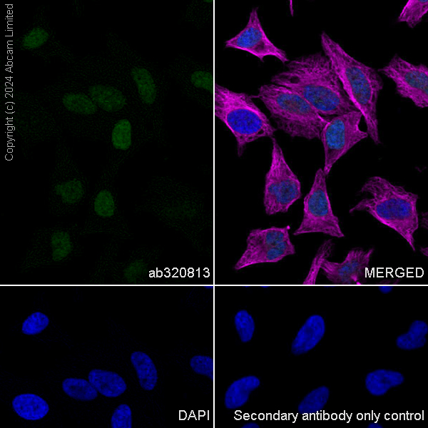 Immunocytochemistry/ Immunofluorescence - Anti-Histone H4 (di methyl K20) antibody [EPR28338-29] (AB320813), expandable thumbnail