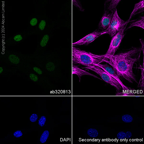 Immunocytochemistry/ Immunofluorescence - Anti-Histone H4 (di methyl K20) antibody [EPR28338-29] (AB320813)