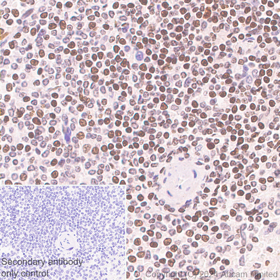 Immunohistochemistry (Formalin/PFA-fixed paraffin-embedded sections) - Anti-Histone H4 (di methyl K20) antibody [EPR28338-29] (AB320813), expandable thumbnail