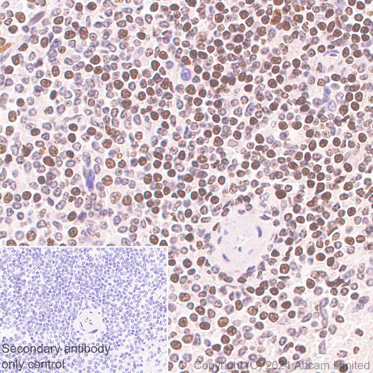 Immunohistochemistry (Formalin/PFA-fixed paraffin-embedded sections) - Anti-Histone H4 (di methyl K20) antibody [EPR28338-29] (AB320813)