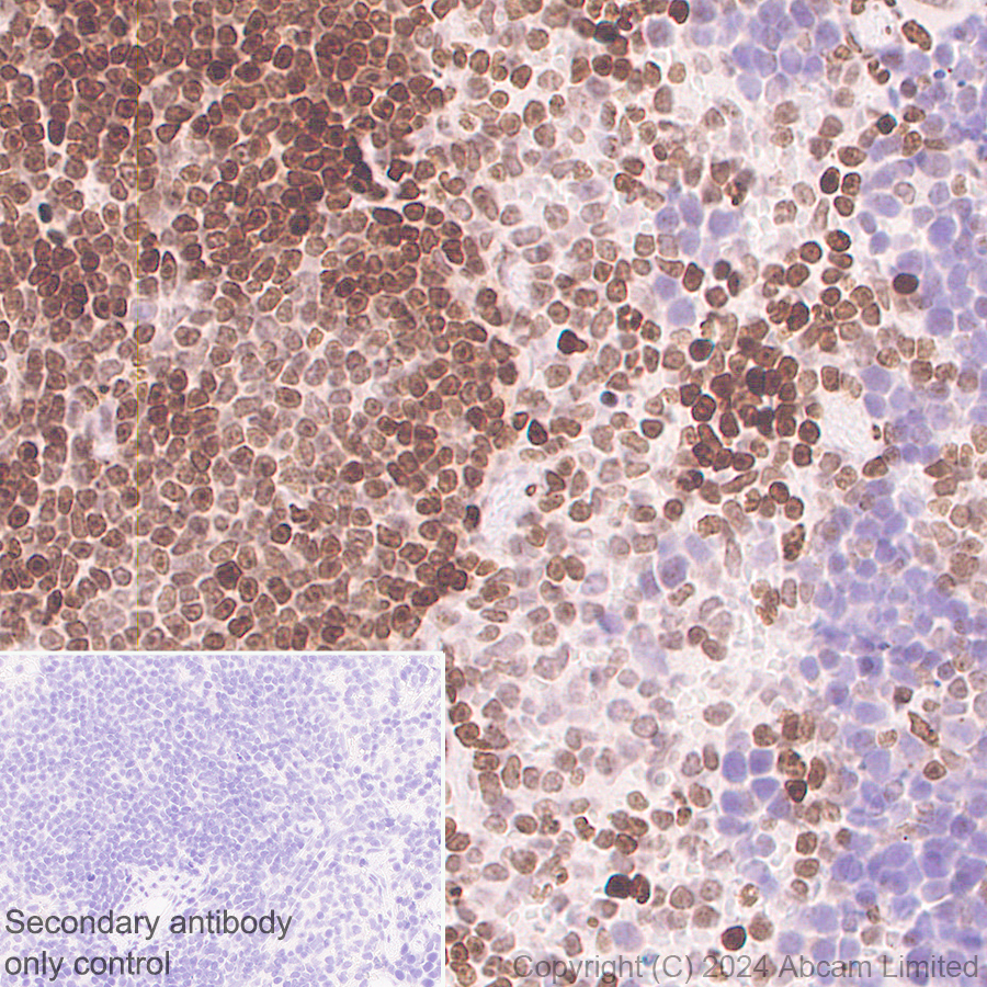 Immunohistochemistry (Formalin/PFA-fixed paraffin-embedded sections) - Anti-Histone H4 (di methyl K20) antibody [EPR28338-29] (AB320813), expandable thumbnail