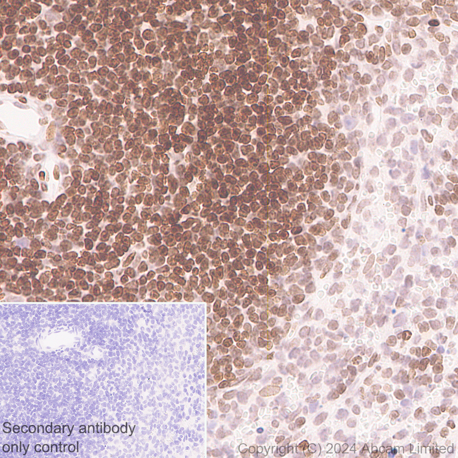 Immunohistochemistry (Formalin/PFA-fixed paraffin-embedded sections) - Anti-Histone H4 (di methyl K20) antibody [EPR28338-29] (AB320813), expandable thumbnail