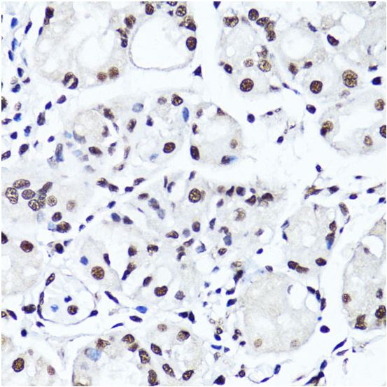 Immunohistochemistry (Formalin/PFA-fixed paraffin-embedded sections) - Anti-Histone H4 (di methyl R3) antibody (AB194696), expandable thumbnail