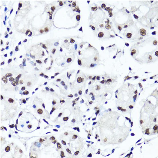 Immunohistochemistry (Formalin/PFA-fixed paraffin-embedded sections) - Anti-Histone H4 (di methyl R3) antibody (AB194696)