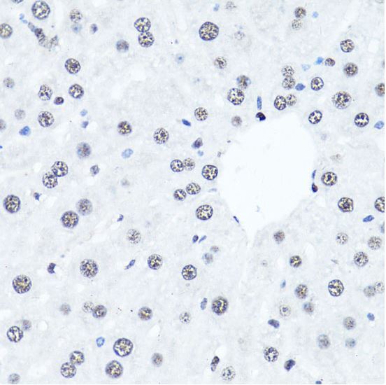 Immunohistochemistry (Formalin/PFA-fixed paraffin-embedded sections) - Anti-Histone H4 (di methyl R3) antibody (AB194696), expandable thumbnail