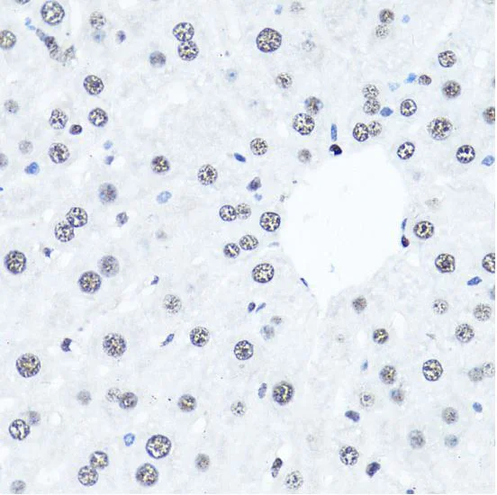 Immunohistochemistry (Formalin/PFA-fixed paraffin-embedded sections) - Anti-Histone H4 (di methyl R3) antibody (AB194696)