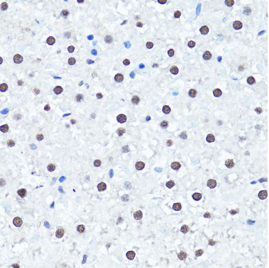 Immunohistochemistry (Formalin/PFA-fixed paraffin-embedded sections) - Anti-Histone H4 (di methyl R3) antibody (ab194696), expandable thumbnail