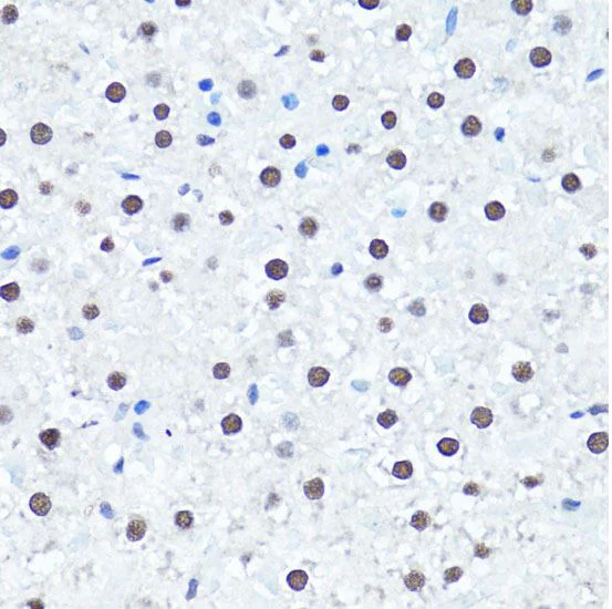Immunohistochemistry (Formalin/PFA-fixed paraffin-embedded sections) - Anti-Histone H4 (di methyl R3) antibody (AB194696)