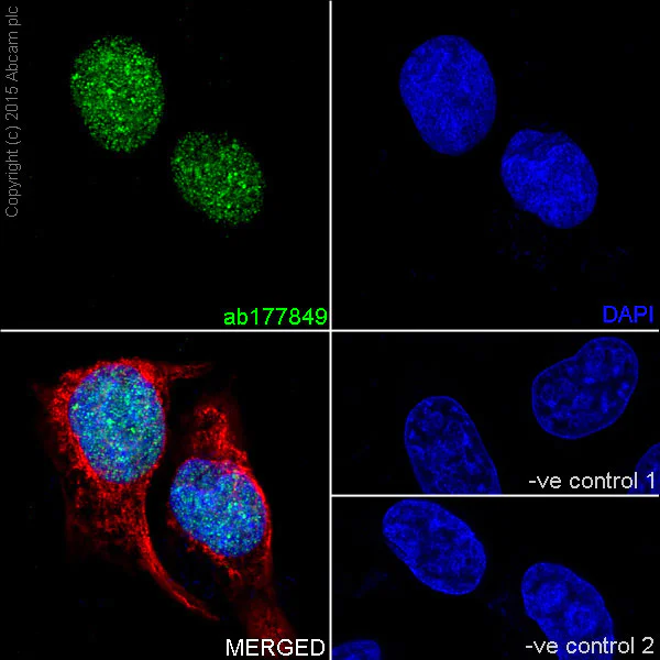 Immunocytochemistry/ Immunofluorescence - Anti-Histone H4 (mono methyl K16) antibody [EPR17910] (AB177849)