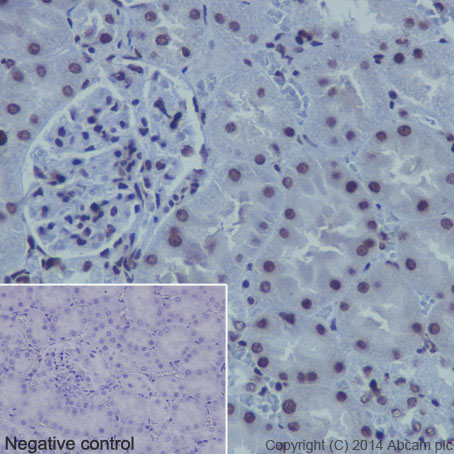 Anti-Histone H4 (mono methyl K20) antibody [EPR16999