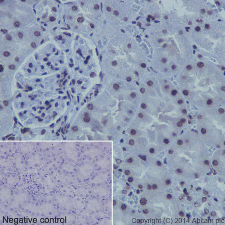 Immunohistochemistry (Formalin/PFA-fixed paraffin-embedded sections) - Anti-Histone H4 (mono methyl K20) antibody [EPR16999] - ChIP Grade (AB177188)