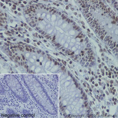 Immunohistochemistry (Formalin/PFA-fixed paraffin-embedded sections) - Anti-Histone H4 (mono methyl K20) antibody [EPR16999] - ChIP Grade (AB177188)