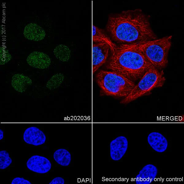 Immunocytochemistry/ Immunofluorescence - Anti-Histone H4 (mono methyl R78) antibody [EPR19561] (AB202036)