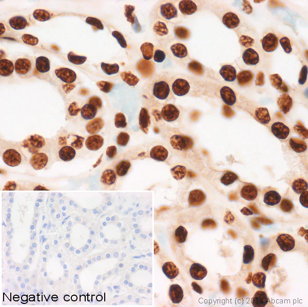 Immunohistochemistry (Formalin/PFA-fixed paraffin-embedded sections) - Anti-Histone H4 (symmetric di methyl R3) antibody (AB5823)