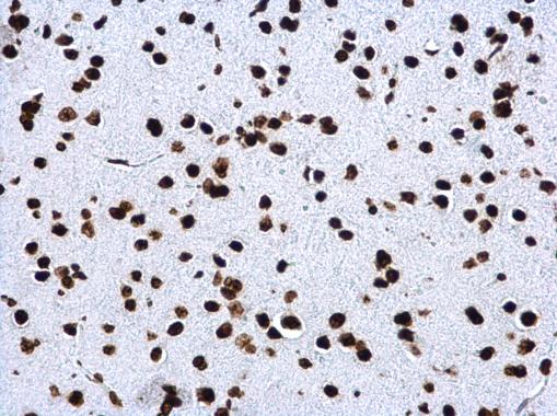 Immunohistochemistry (Formalin/PFA-fixed paraffin-embedded sections) - Anti-Histone H4 (tri methyl K20) antibody (ab227884), expandable thumbnail