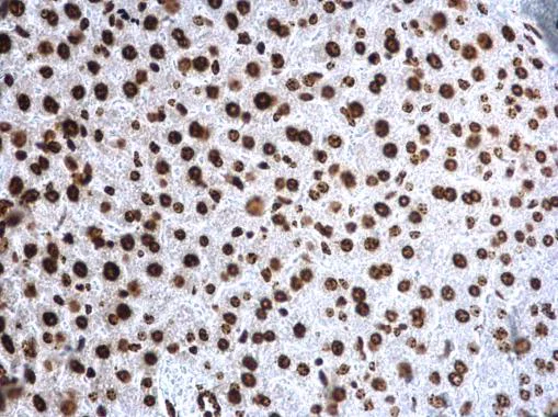Immunohistochemistry (Formalin/PFA-fixed paraffin-embedded sections) - Anti-Histone H4 (tri methyl K20) antibody (AB227884)