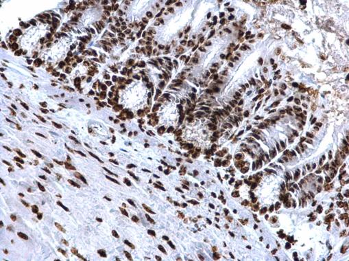 Immunohistochemistry (Formalin/PFA-fixed paraffin-embedded sections) - Anti-Histone H4 (tri methyl K20) antibody (AB227884), expandable thumbnail