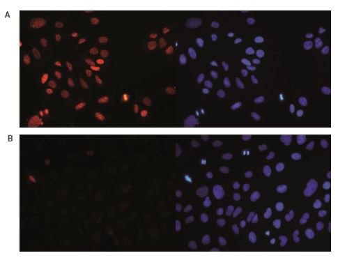 Immunocytochemistry/ Immunofluorescence - Anti-Histone H4 (tri methyl K20) antibody - ChIP Grade (AB195479), expandable thumbnail