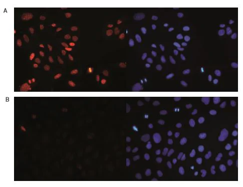 Immunocytochemistry/ Immunofluorescence - Anti-Histone H4 (tri methyl K20) antibody - ChIP Grade (AB195479)