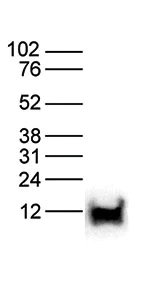 Western blot - Anti-Histone H4 (tri methyl K20) antibody - ChIP Grade (AB195479)