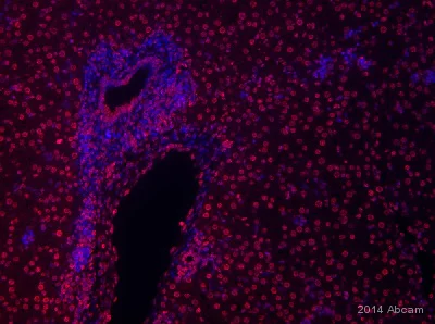 Immunohistochemistry (Formalin/PFA-fixed paraffin-embedded sections) - Anti-Histone H4 (tri methyl K20) antibody - ChIP Grade (AB9053)