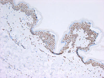 Immunohistochemistry (Formalin/PFA-fixed paraffin-embedded sections) - Anti-Histone H4 (tri methyl K20) antibody - ChIP Grade (AB9053)