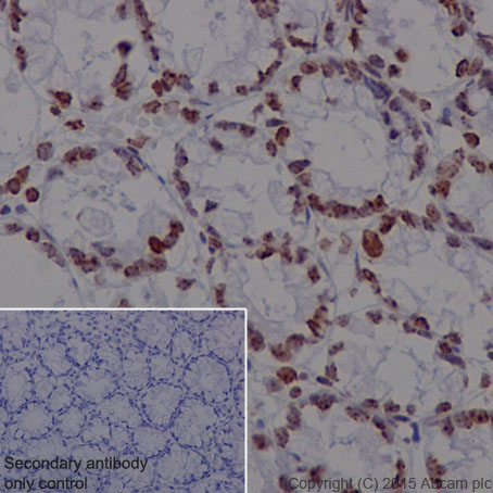 Immunohistochemistry (Formalin/PFA-fixed paraffin-embedded sections) - Anti-Histone H4 (tri methyl K20) antibody [EPR17001(2)] - BSA and Azide free (AB239410), expandable thumbnail