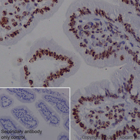 Immunohistochemistry (Formalin/PFA-fixed paraffin-embedded sections) - Anti-Histone H4 (tri methyl K20) antibody [EPR17001(2)] - BSA and Azide free (AB239410), expandable thumbnail