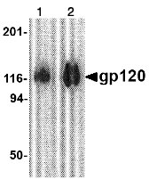 Western blot - Anti-HIV1 gp120 antibody (AB106578), expandable thumbnail