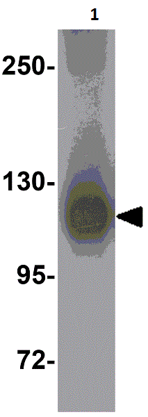 Western blot - Anti-HIV1 gp120 antibody (AB106578), expandable thumbnail