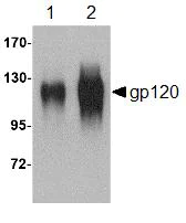Western blot - Anti-HIV1 gp120 antibody (AB85054)