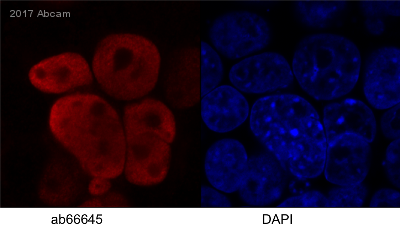 Immunocytochemistry/ Immunofluorescence - Anti-HIV1 integrase antibody [IN-2] (AB66645)