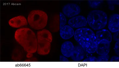 Immunocytochemistry/ Immunofluorescence - Anti-HIV1 integrase antibody [IN-2] (AB66645)