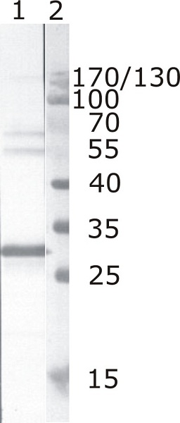 Western blot - Anti-HIV1 Nef antibody [JR6] (AB42358), expandable thumbnail