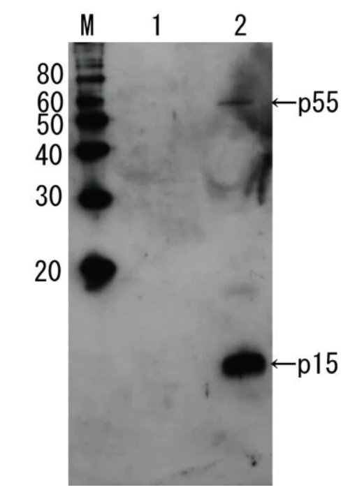 Western blot - Anti-HIV1 p15 antibody (AB66951)