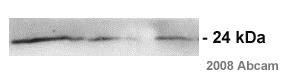 Western blot - Anti-HIV1 p24 antibody [5] (AB63958), expandable thumbnail
