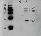Western blot - Anti-HIV1 p24 antibody (AB63913), expandable thumbnail