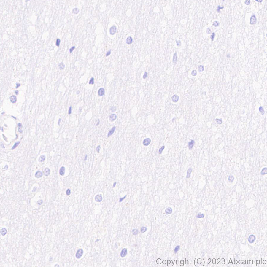 Immunohistochemistry (Formalin/PFA-fixed paraffin-embedded sections) - Anti-HIV1 p55 + p24 antibody [EPR27327-79] (AB308072)