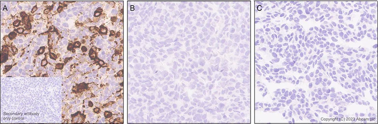 Immunohistochemistry (Formalin/PFA-fixed paraffin-embedded sections) - Anti-HIV1 p55 + p24 antibody [EPR27327-79] - BSA and Azide free (AB308073)