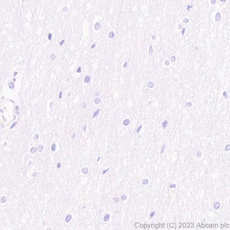 Immunohistochemistry (Formalin/PFA-fixed paraffin-embedded sections) - Anti-HIV1 p55 + p24 antibody [EPR27327-79] - BSA and Azide free (AB308073)