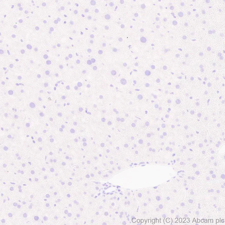 Immunohistochemistry (Formalin/PFA-fixed paraffin-embedded sections) - Anti-HIV1 p55 + p24 antibody [EPR27327-79] - BSA and Azide free (AB308073)
