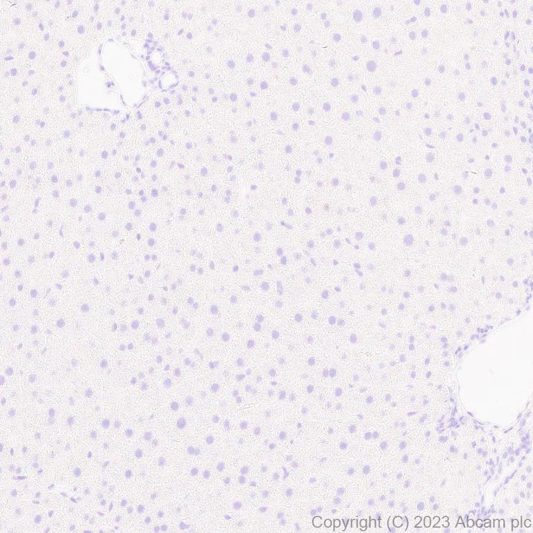 Immunohistochemistry (Formalin/PFA-fixed paraffin-embedded sections) - Anti-HIV1 p55 + p24 antibody [EPR27327-79] - BSA and Azide free (AB308073)