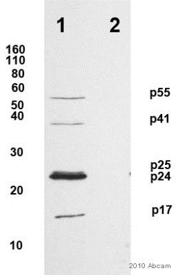 Western blot - Anti-HIV1 p55 + p24 + p17 antibody (AB63917), expandable thumbnail