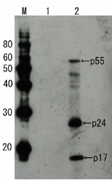 Western blot - Anti-HIV1 p55 + p24 + p17 antibody (AB63917), expandable thumbnail