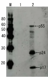 Western blot - Anti-HIV1 p55 + p24 + p17 antibody (AB63917)