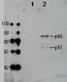 Western blot - Anti-HIV1 Reverse Transcriptase antibody (AB63911)
