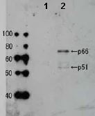 Western blot - Anti-HIV1 Reverse Transcriptase antibody (AB63911)