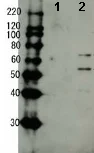 Western blot - Anti-HIV1 Reverse Transcriptase antibody (AB63912)