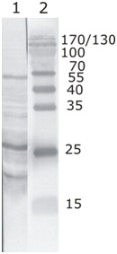Western blot - Anti-HIV1 tat antibody [1] (AB42359)