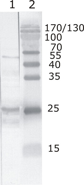 Western blot - Anti-HIV1 tat antibody [N1] (AB42360)